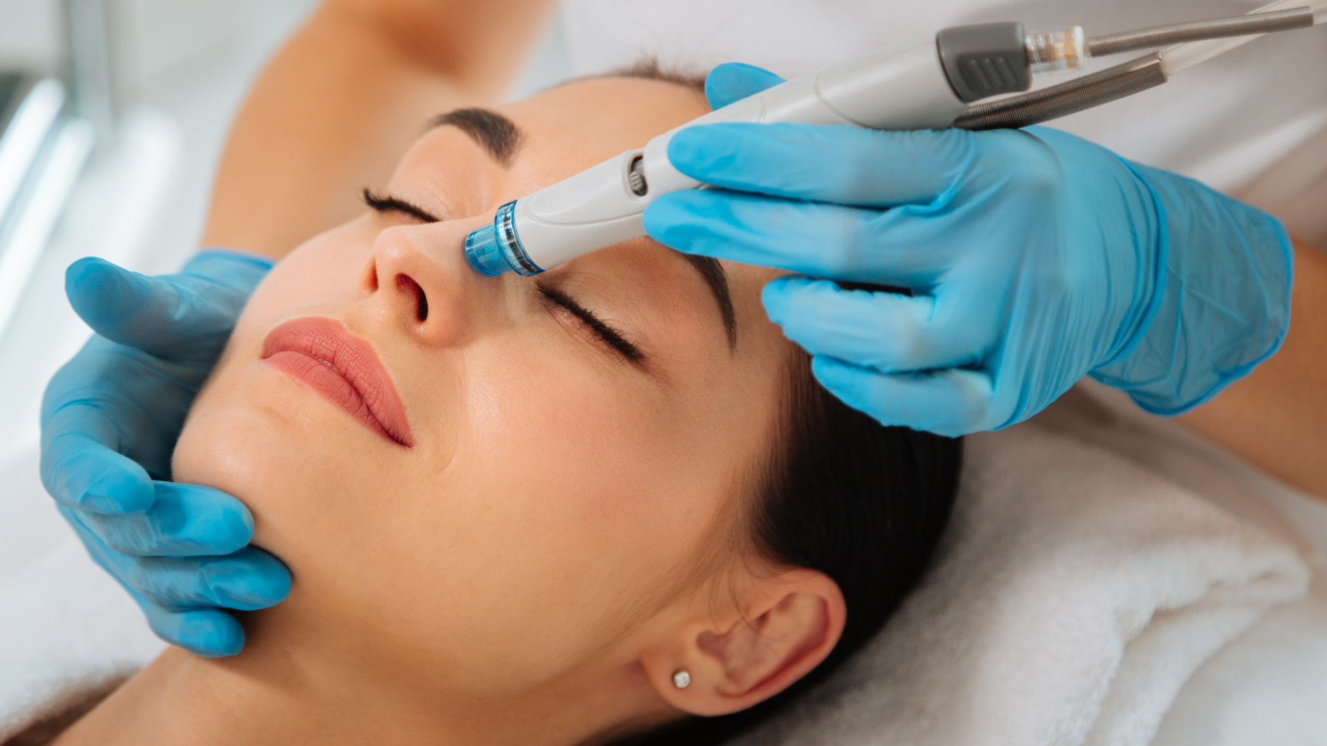 Hydrafacial Erlebnisbericht